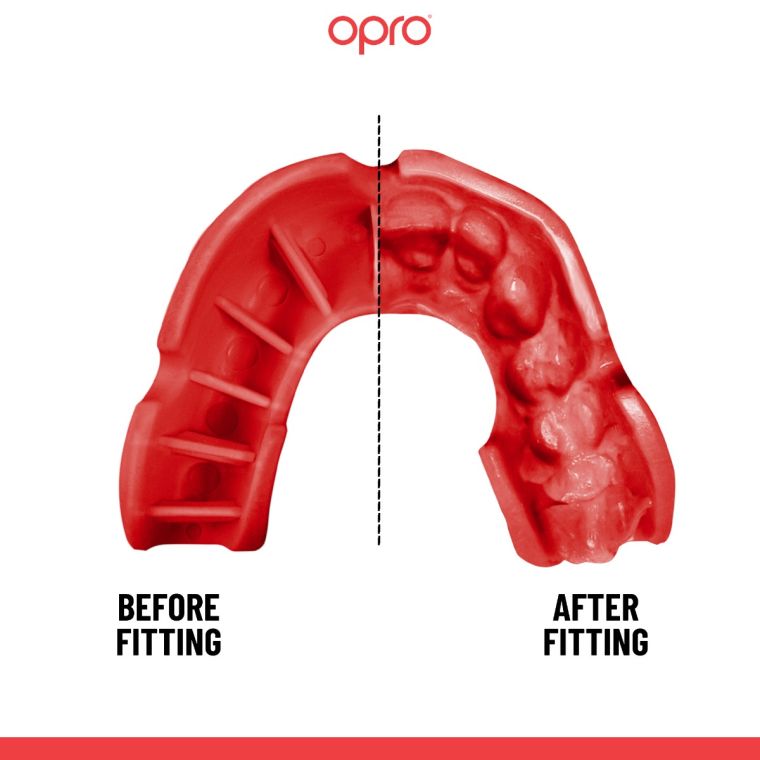 Opro Bucal Self-Fit G5 - Silver