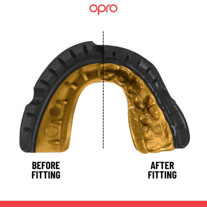 Opro Bucal Self-Fit Gold Braces
